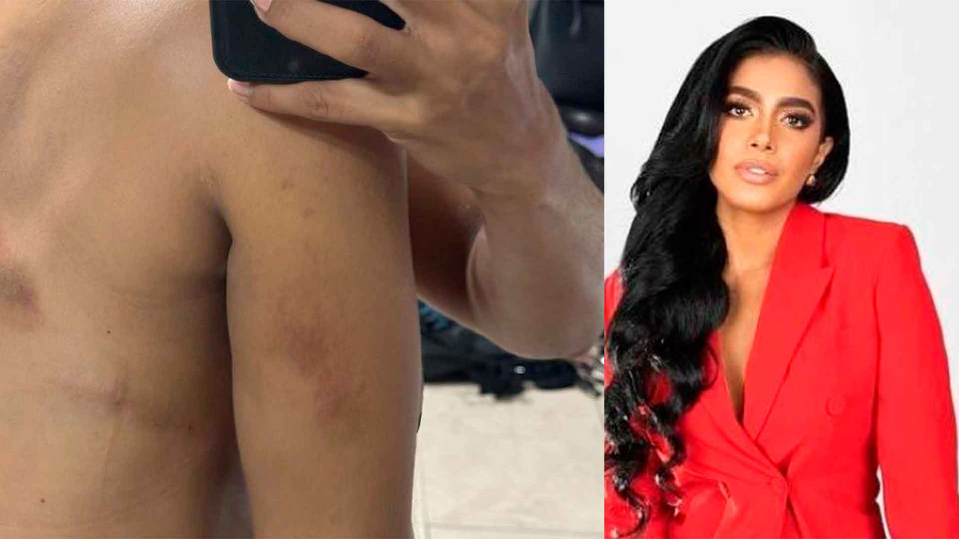 Presentadora Andreina Díaz denunció agresión física de su expareja