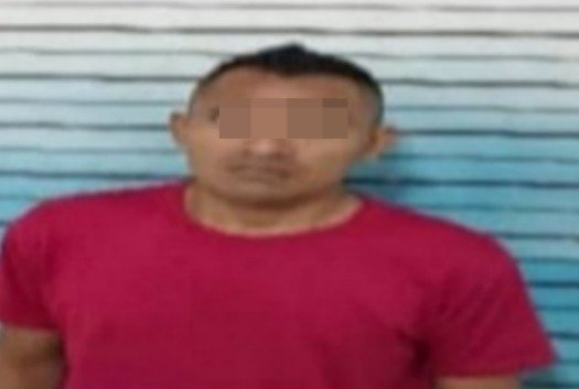 Hombre le arrancó un pedazo de nariz a su expareja
