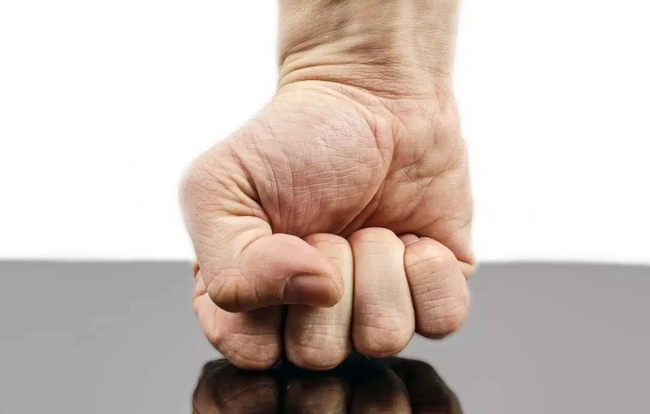 Recibió una golpiza al ser acusado falsamente de violación en Upata