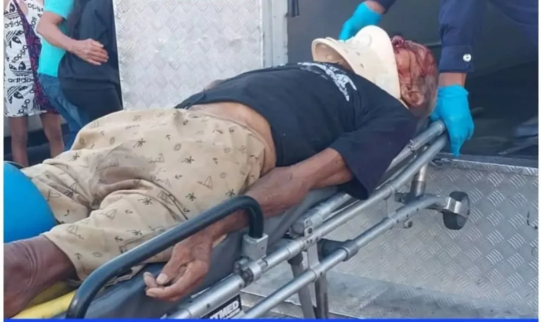 Octogenario murió tras ser arrollado por un motopiruetas