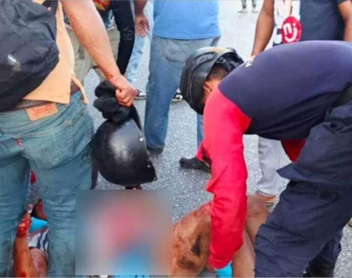 Pareja de motorizados resultaron lesionados tras ser arrollados en Puerto Cabello