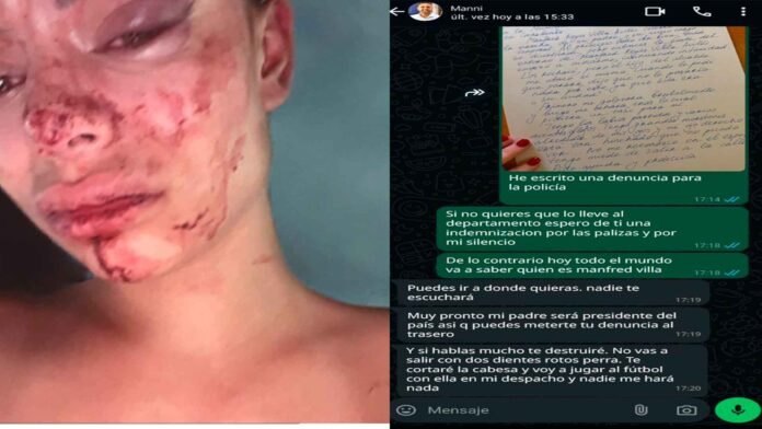 La niña golpeada por Manfred Reyes Villa Avilés le exigió una indemnización